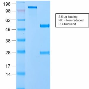 SDS-PAGE Analysis of Purified VLDL-Receptor Rabbit Recombinant Monoclonal Antibody (VLDLR/2896R). Confirmation of Purity and Integrity of Antibody.