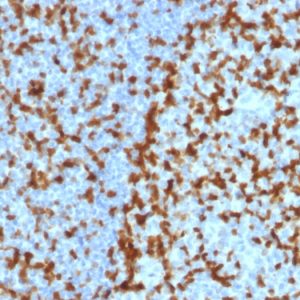 Formalin-fixed, paraffin-embedded human Tonsil stained with ZAP70 Mouse Monoclonal Antibody (ZAP70/2047).