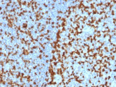 Formalin-fixed, paraffin-embedded human Tonsil stained with ZAP70 Mouse Monoclonal Antibody (ZAP70/2047).