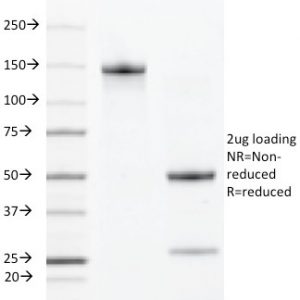 SDS-PAGE Analysis Purified VEGFR2 Rat Monoclonal Antibody (DC101). Confirmation of Purity and Integrity of Antibody.
