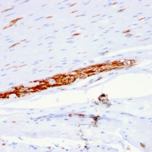 Formalin-fixed, paraffin-embedded human Colon stained with CD56 Mouse Monoclonal Antibody (ERIC-1).