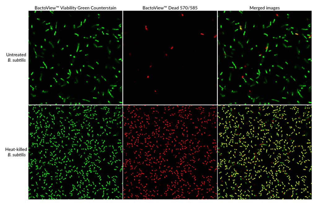 Microbiology Stains, Kits & Dyes | Bacteria, Yeast & Viability PCR ...