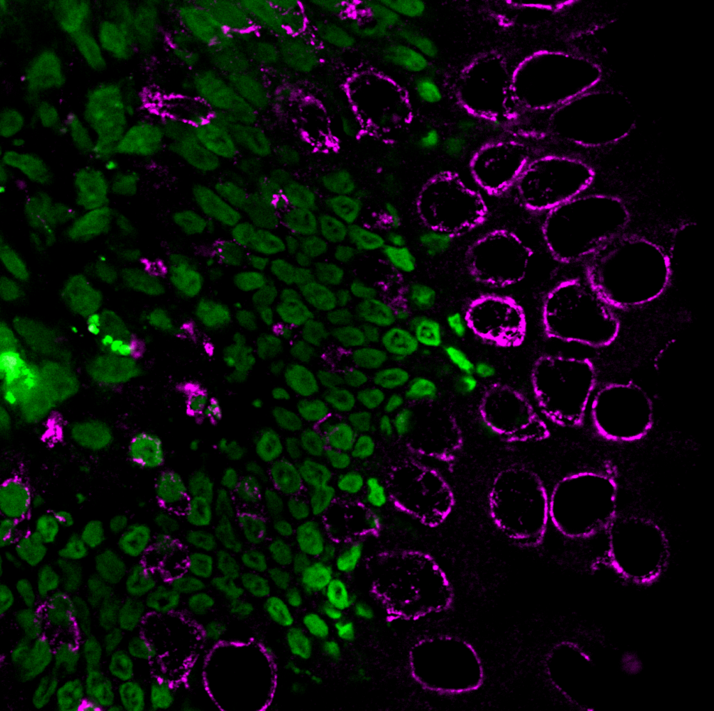 There is a histology image of cells on a black background. Some are stained green, and some are stained magenta.