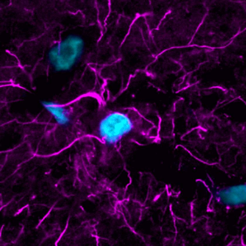 TrueBlack® Lipofuscin Autofluorescence Quencher