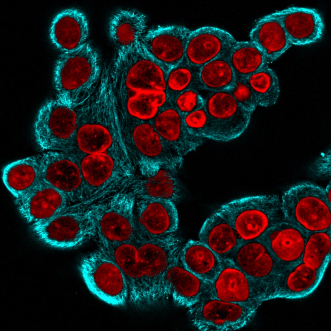 MCF-7 cells stained with mouse anti-tubulin fluorescent conjugated antibodies
