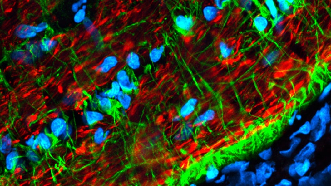 rat optic nerve stained with mouse anti-neurofilament H and CF568 goat anti-mouse