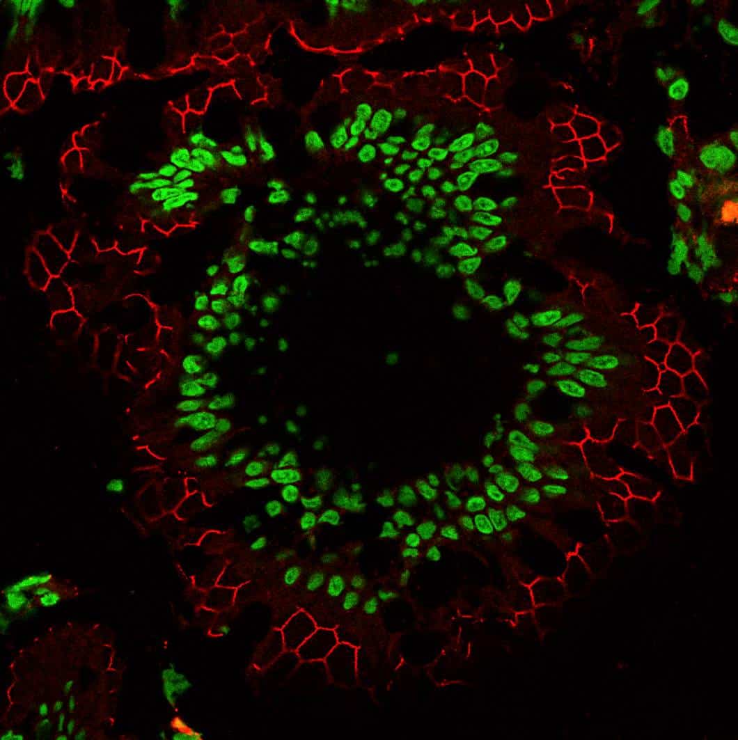 rat intestine cryosection blocked and stained with fluorescence microscopy products