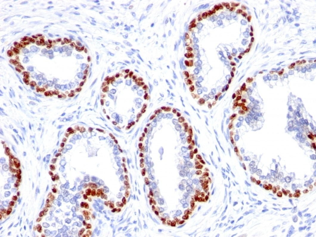 immunohistochemistry of tissue stained with antibody products