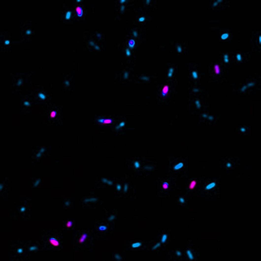 microbes stained with microbiology products