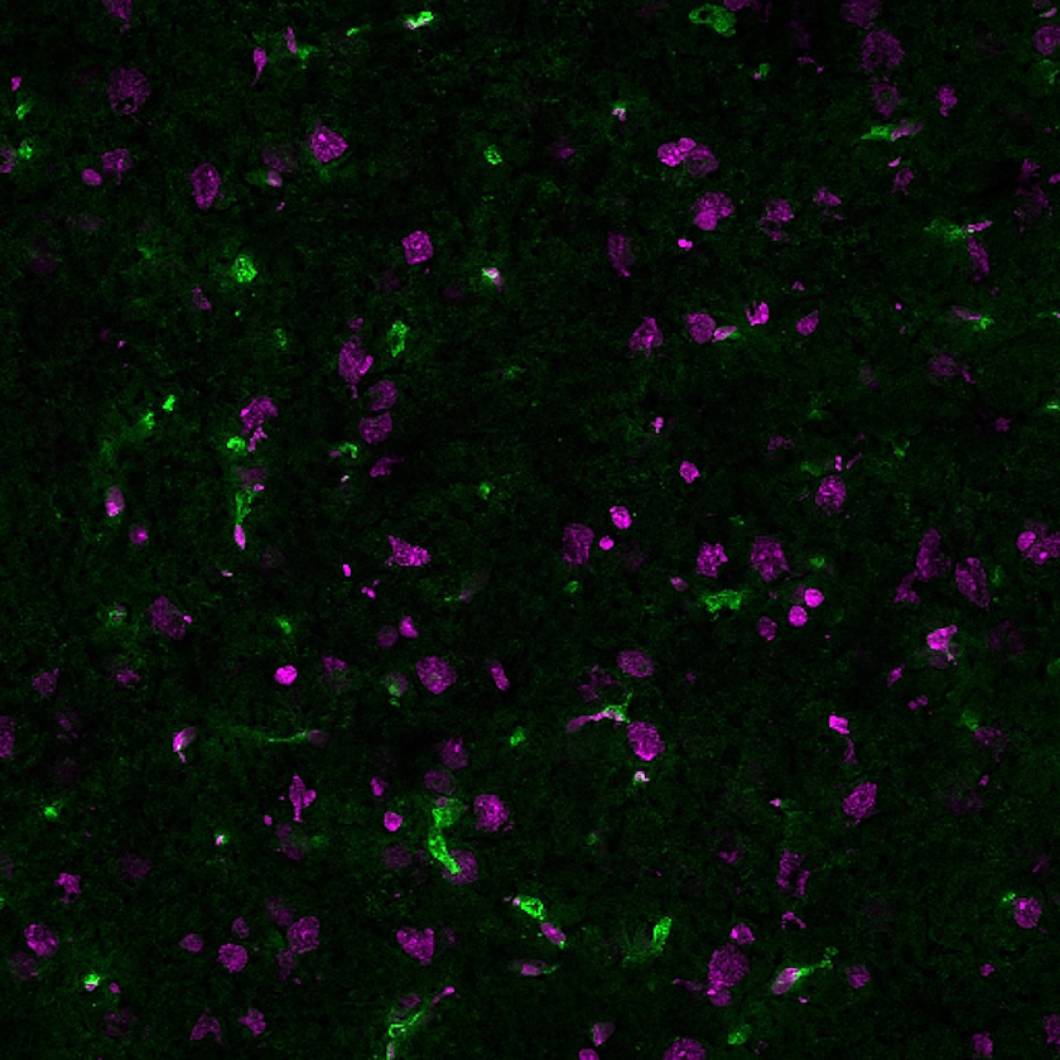 rat brain cryosection stained with neuroscience research products including CF 488A LEL, TL