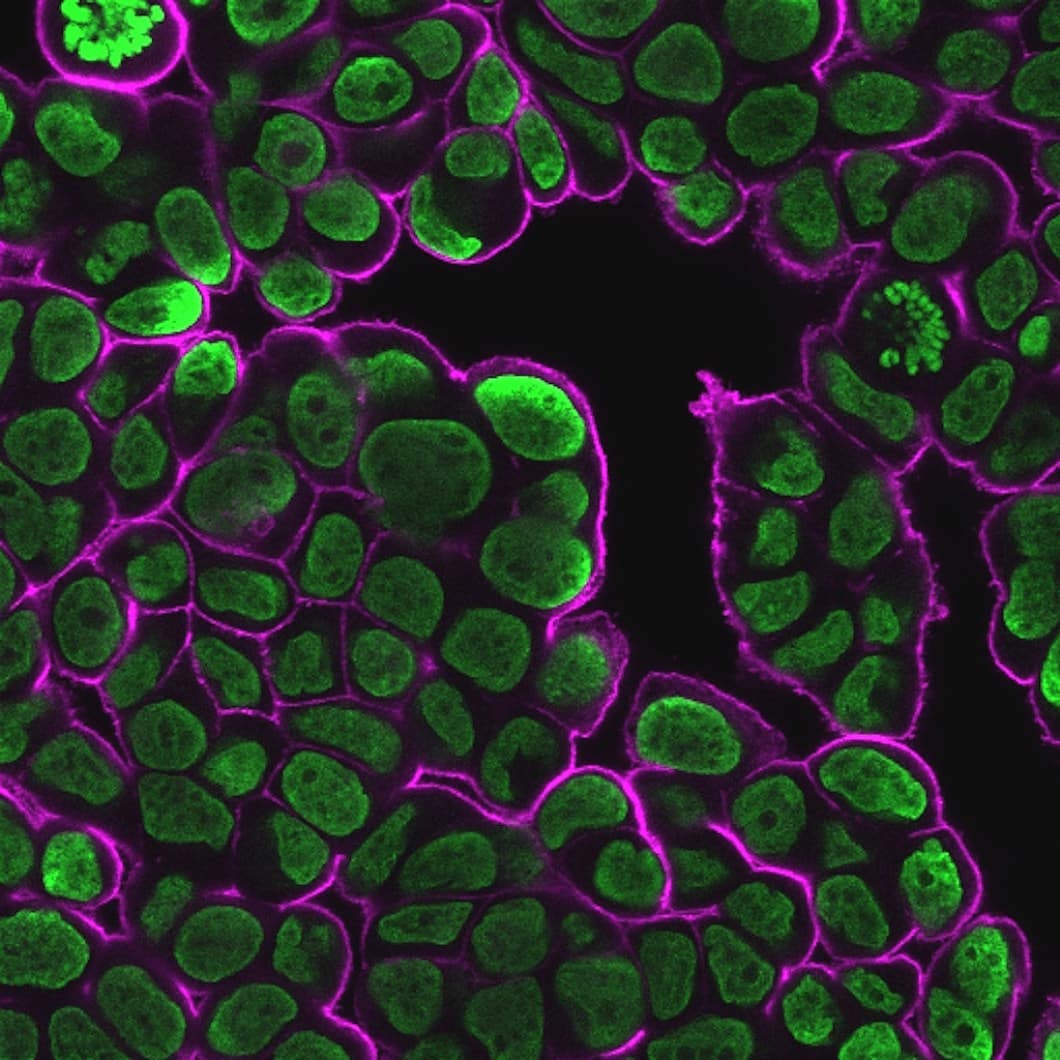 MCF7 cells stained with NucSpot 500/515 (green) and CytoLiner 650/675 (magenta)