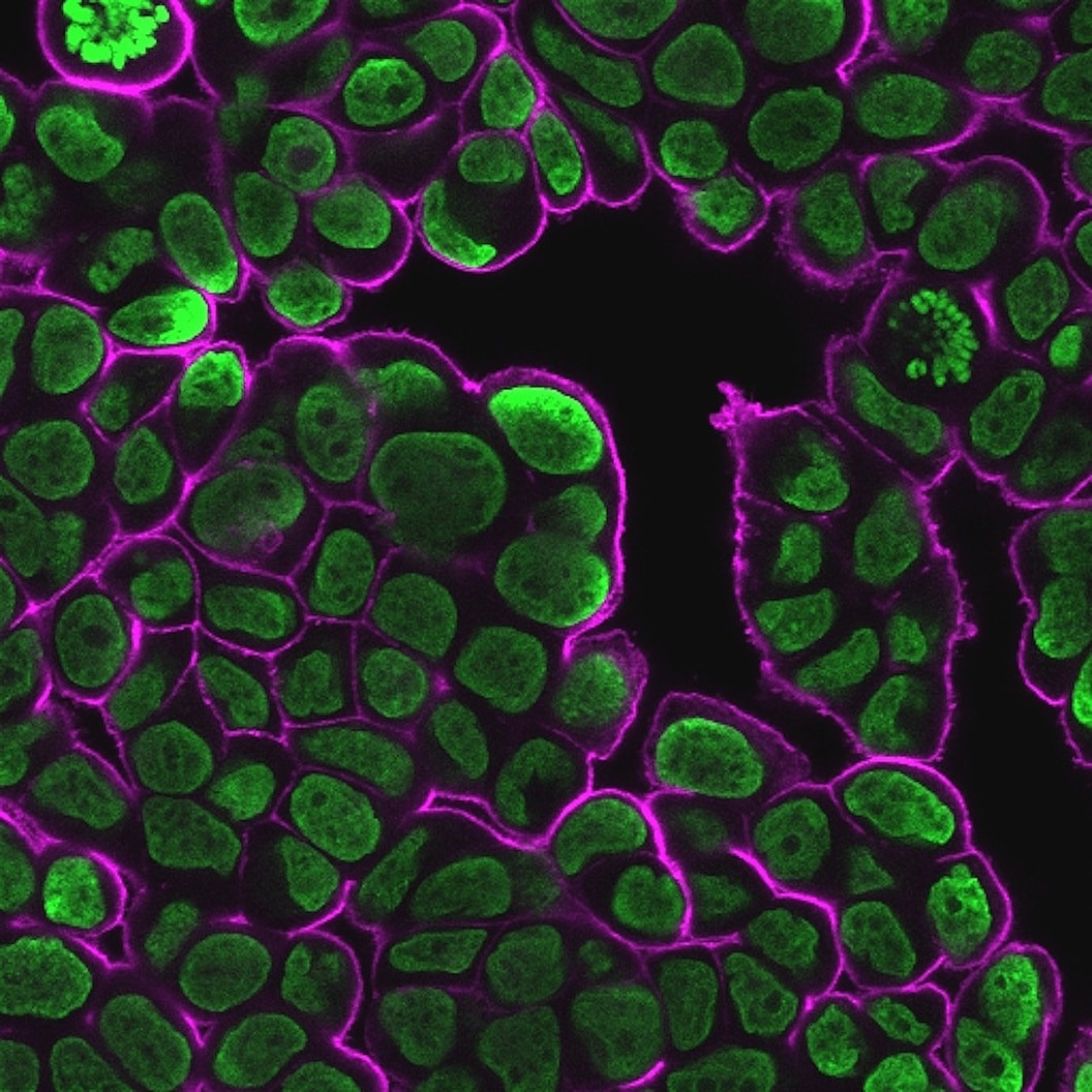 MCF7 cells stained with NucSpot 500/515 (green) and CytoLiner 650/675 (magenta)