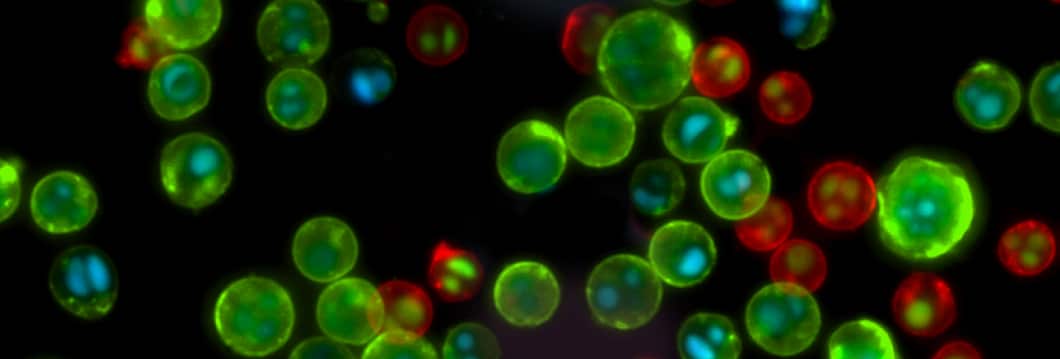 fluorescent-labeled cells