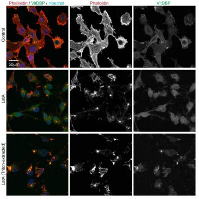 Recombinant Human Vitamin D-Binding Protein Conjugates - Image 2